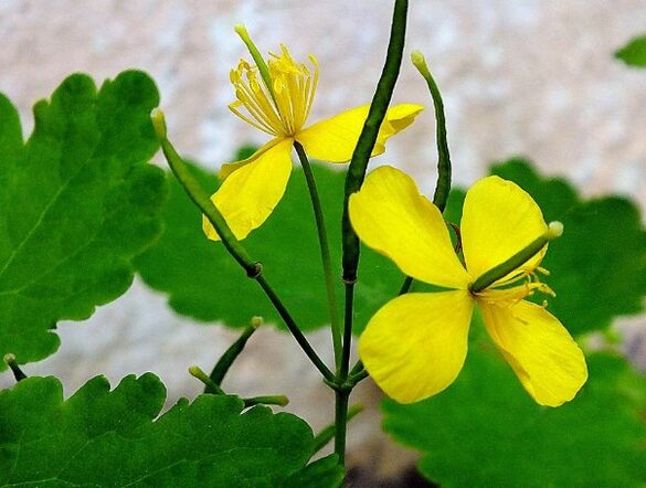 CELANDINE for the treatment of psoriasis