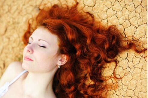 Girl with psoriasis